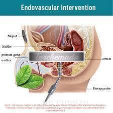 Girl Benigna  Torino