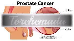 Girl Benigna  Torino